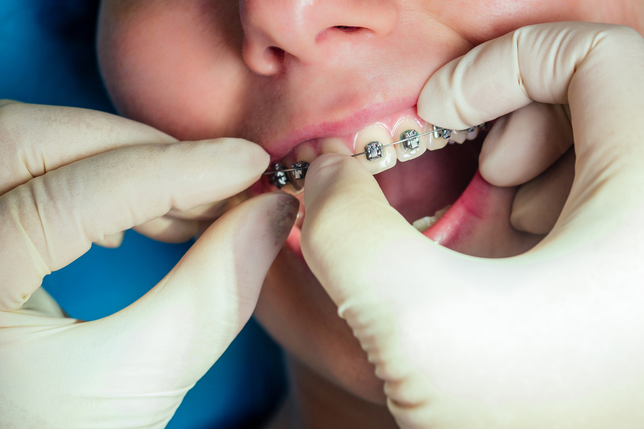 Hábitos que Impactan la Dentadura Infantil