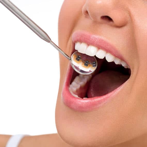 Dr. Javier Trejos 3 Ortodoncia invisible en Panamá