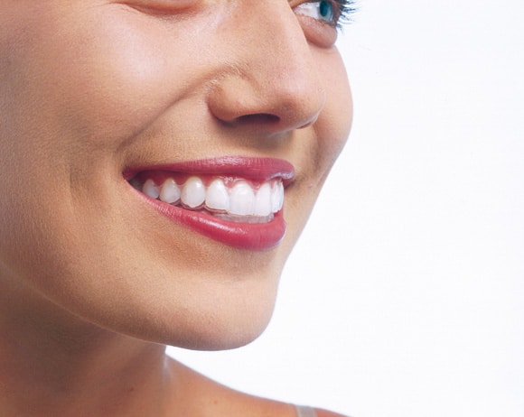 La sonrisa que buscas con Invisalign
