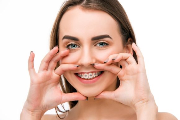 Invisalign tiene muchas ventajas sobre brackets tradicionales