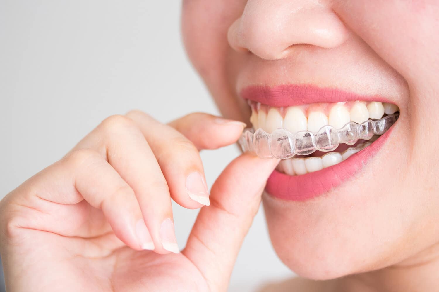 invisalign en panama