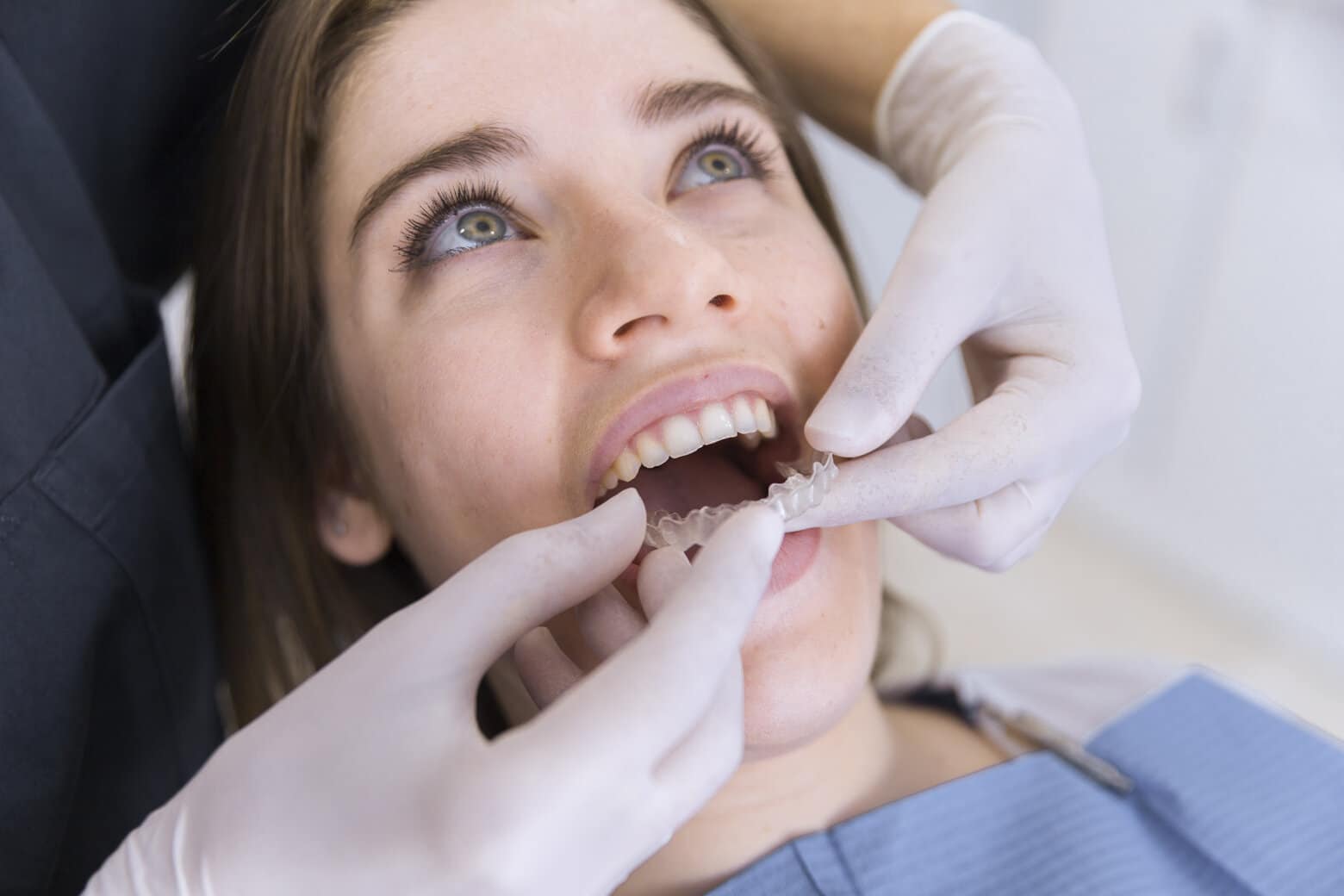 Ortodoncia con alineadores transparentes como Invisalign teen