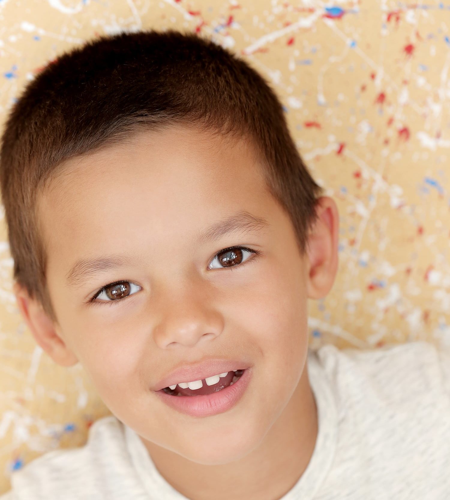 Como Tratar El Diastema Como tratar el Diastema