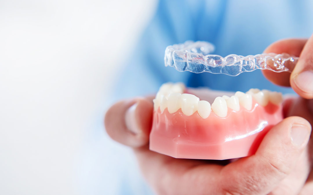 ¿Cuánto tiempo dura un tratamiento con Invisalign?