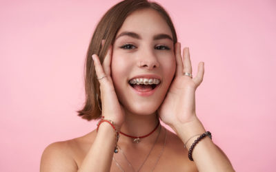Cuidados después de los brackets