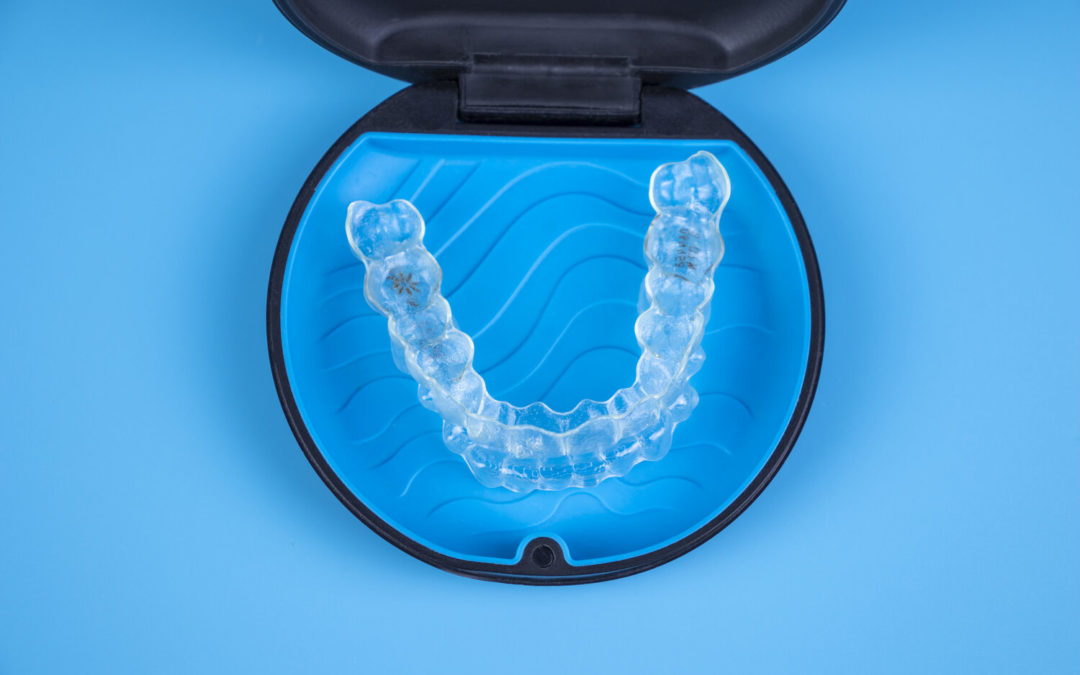 Invisalign Express; la solución de los casos leves