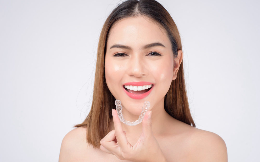 ¿Cómo funcionan los aparatos de ortodoncia Invisalign?