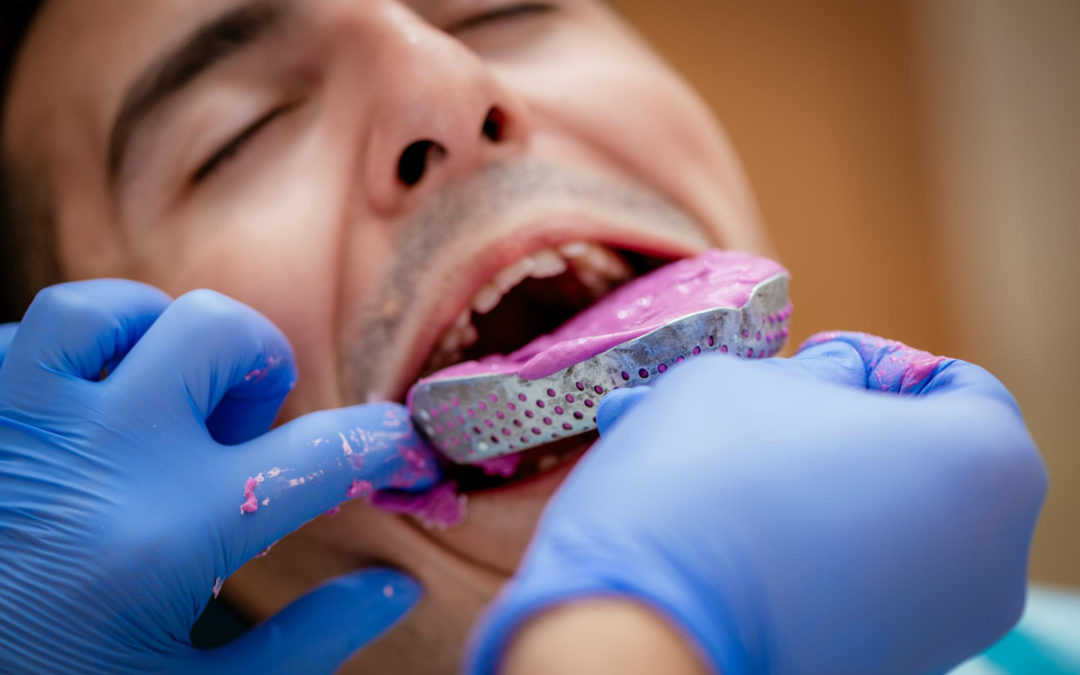 Ortodoncia removible: ¿Qué es y quiénes pueden usarla?