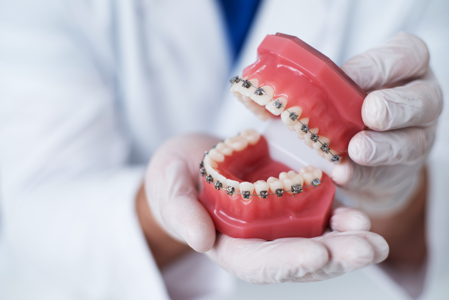 Qué beneficios ofrece el uso del kit de ortodoncia