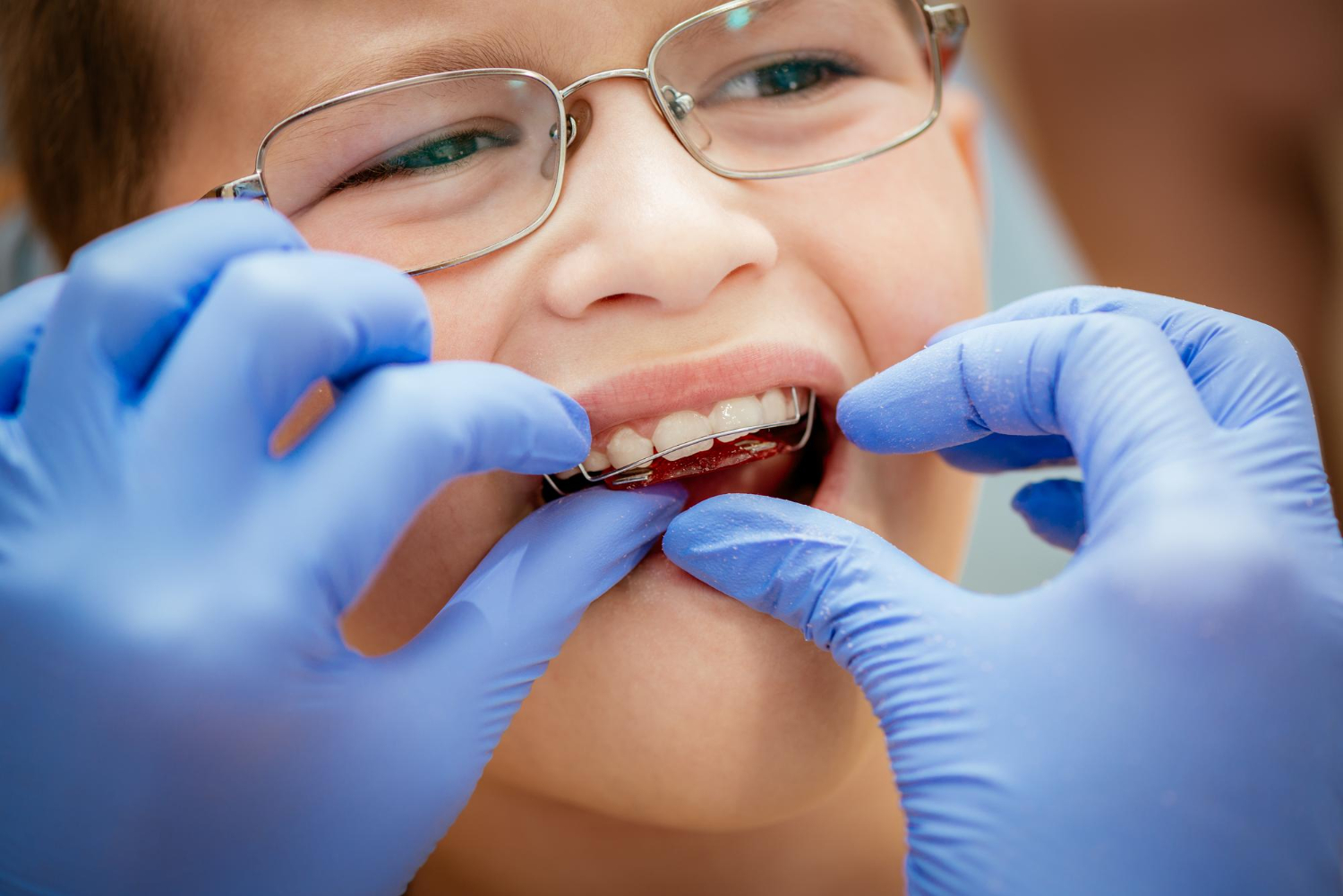 Qué es la ortodoncia removible - Dr. Trejos
