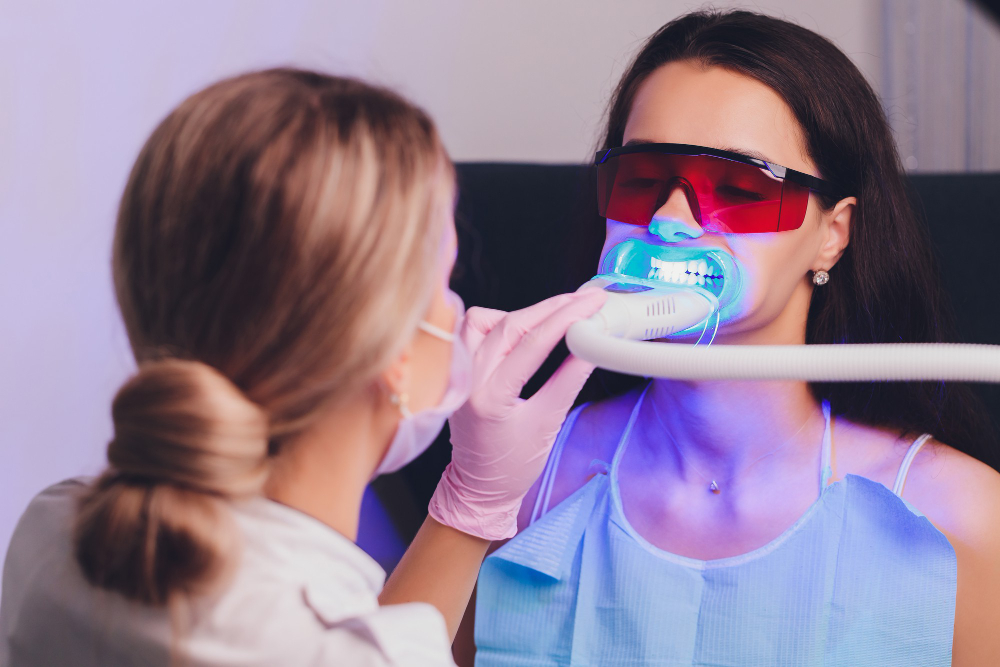 Las 10 principales ventajas del blanqueamiento dental