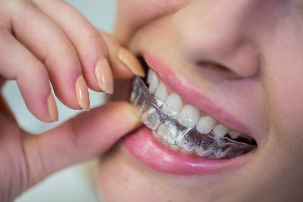 Ferula Dental ferula dental