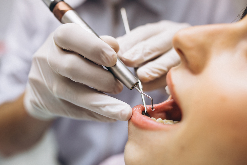 Periodoncia periodoncia
