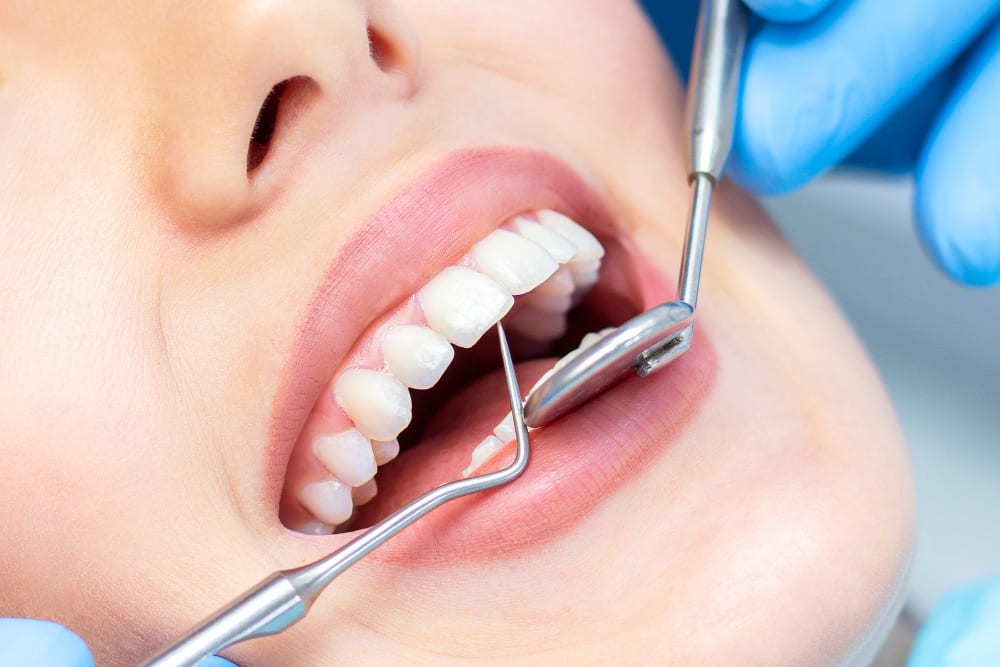 Benefits of dental filling
