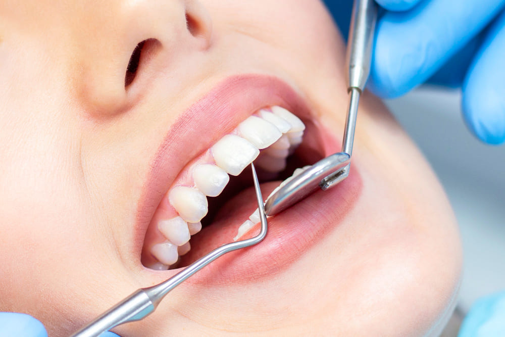 Beneficios del empaste dental