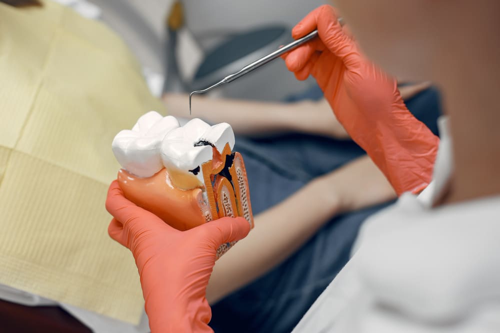 What are dental fillings