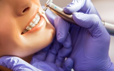 Importancia de los retenedores en ortodoncia