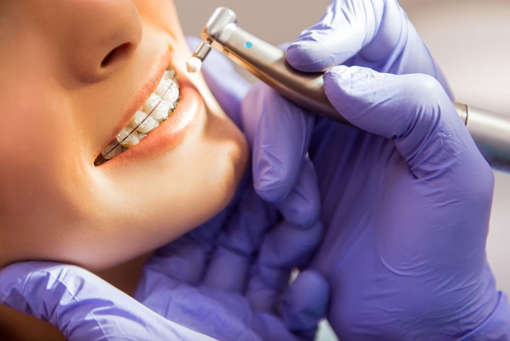 Importancia de los retenedores en ortodoncia