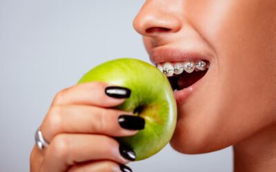 What foods can I eat with braces and why?