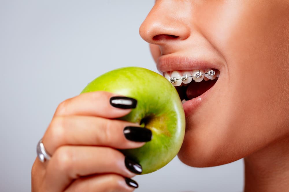 Qué alimentos puedo comer con brackets ¿Y por qué?