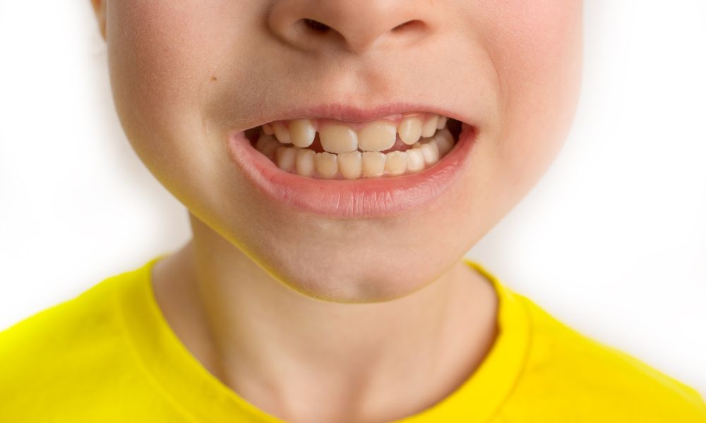 Tratamientos para la maloclusión dental