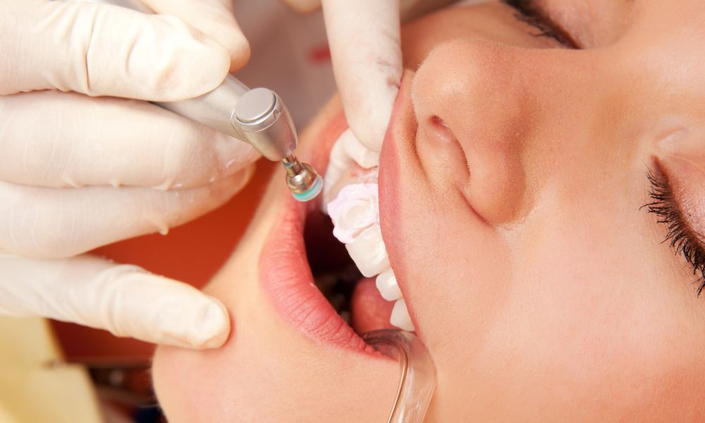 Tratamientos de la Hipoplasia Dental
