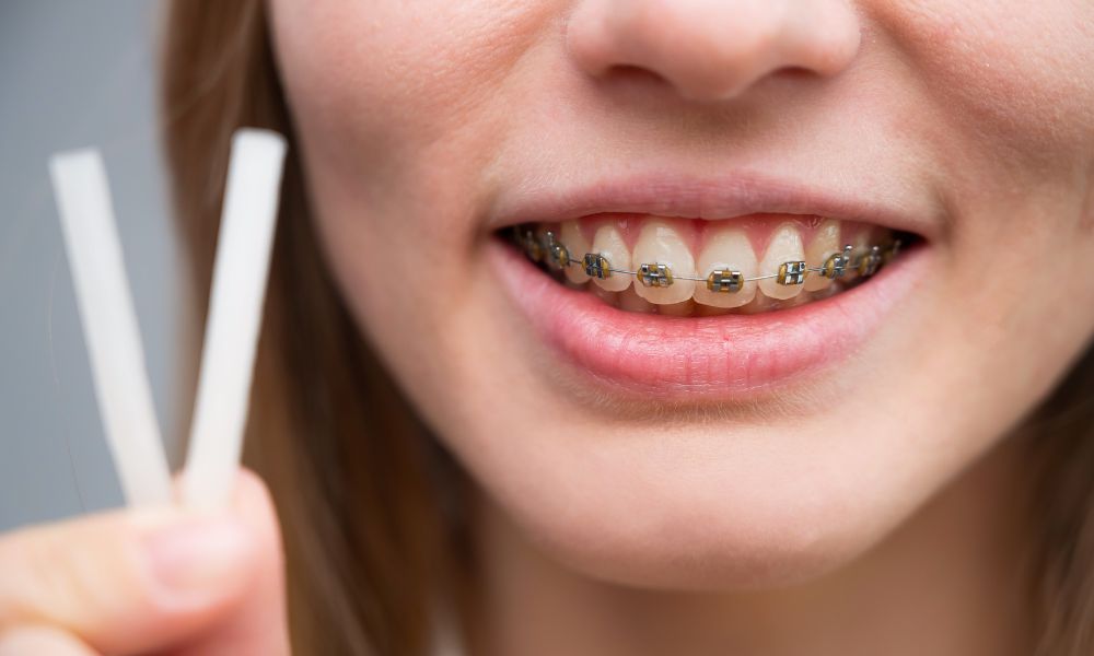 Alternativas a la Cera Dental