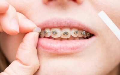 Qué Sucede si Ingiere Cera Dental: Información y Consejos