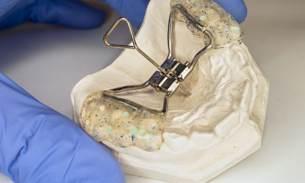 Tipos de Expansores de Paladar<br />
