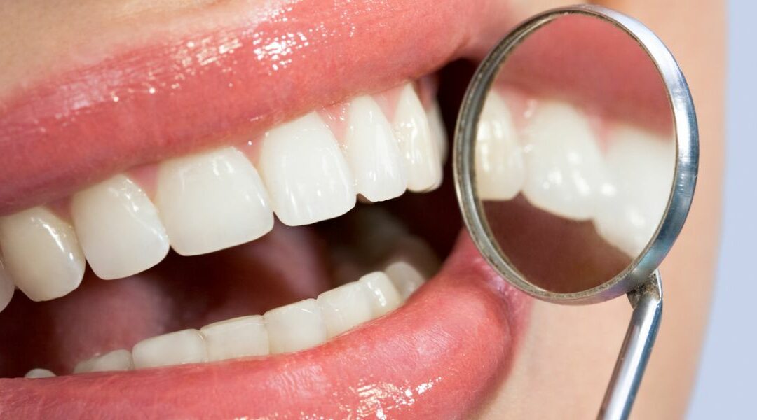 All about Dental Stripping in Orthodontics