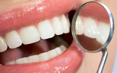 Todo sobre el Stripping Dental en Ortodoncia