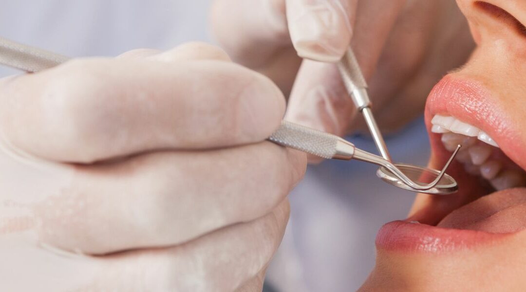 ¿Se Pueden Limar los Dientes?