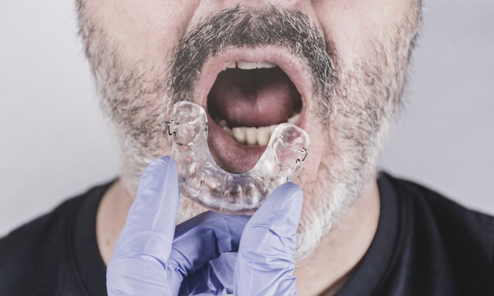 Qué Es Una Férula Dental: Guía Completa 1 Tipos de férulas dentales y sus aplicaciones