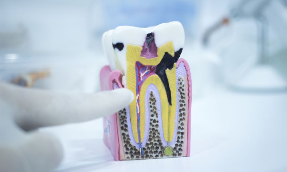 Entendiendo el esmalte dental y sus funciones