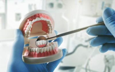 Consecuencias de una Higiene Bucal Deficiente