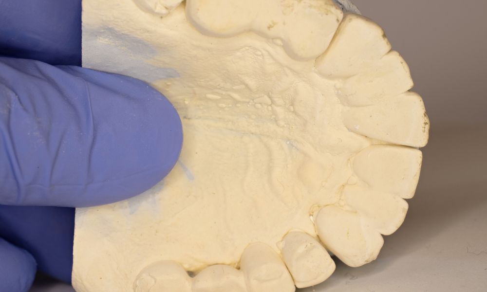 Etapas del tratamiento ortodóntico para cerrar espacios dentales