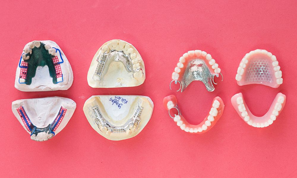 Factores que influyen en la duración del tratamiento para cerrar espacios dentales