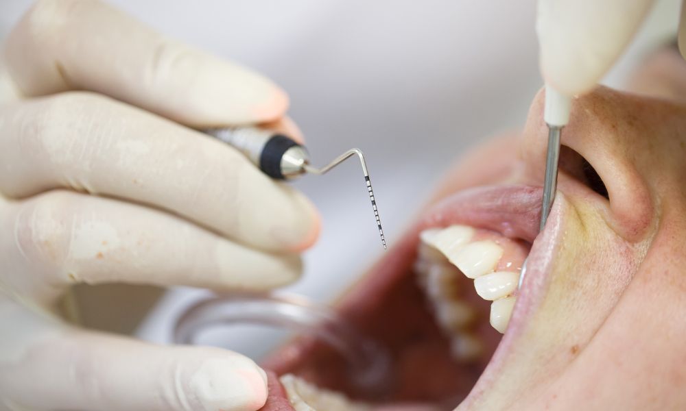 Mantenimiento periodontal durante y después de la ortodoncia