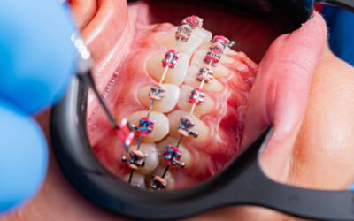 Análisis facial ortodoncia: Guía para tu tratamiento