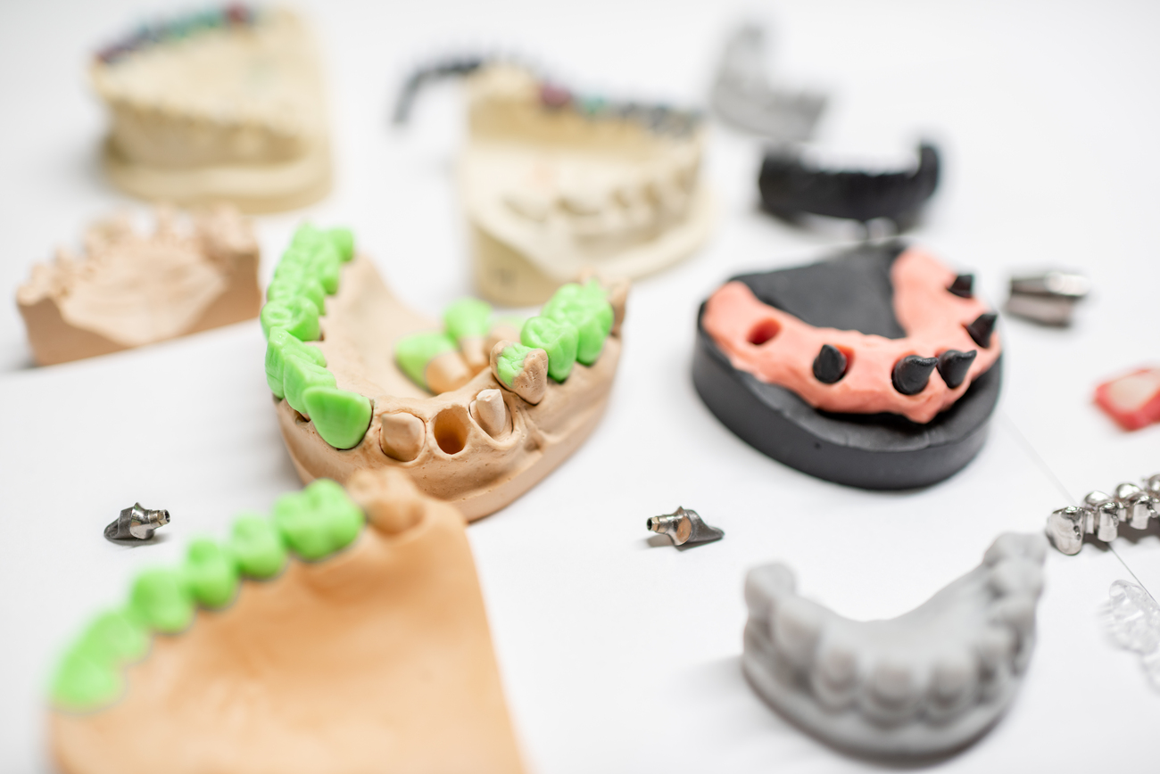 Qué son las prótesis dentales