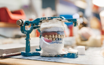 Blog De Ortodoncía En Panamá 1 Tipos de Prótesis Dentales: Encuentra la Mejor Opción para Ti