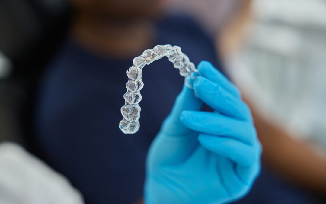 Cuándo no se recomienda Invisalign: 7 limitaciones del tratamiento