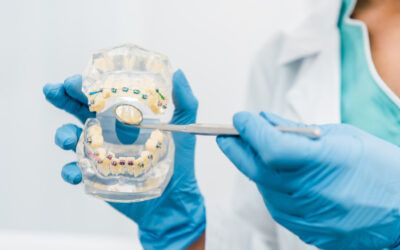 Causas Comunes de Ortodoncia en Jóvenes y Soluciones