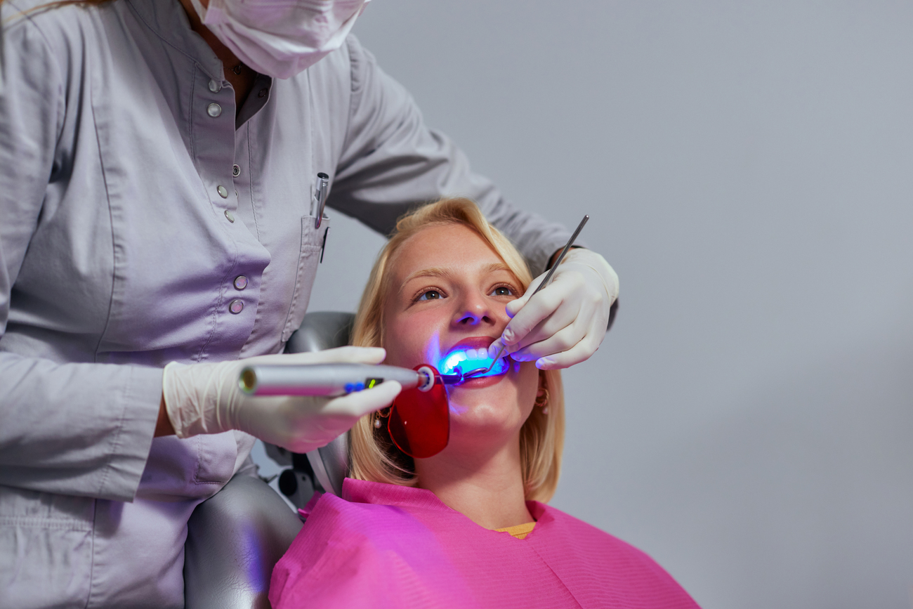 Opciones de blanqueamiento dental profesional