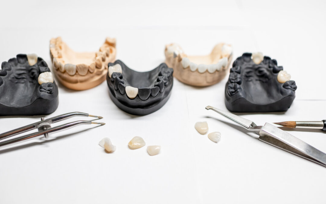Qué Prótesis es Mejor si me Faltan Todos los Dientes