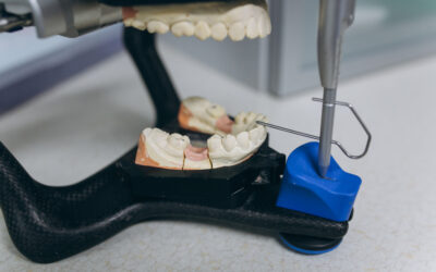 Cuánto Tiempo Dura una Prótesis Dental con Cuidados Adecuados