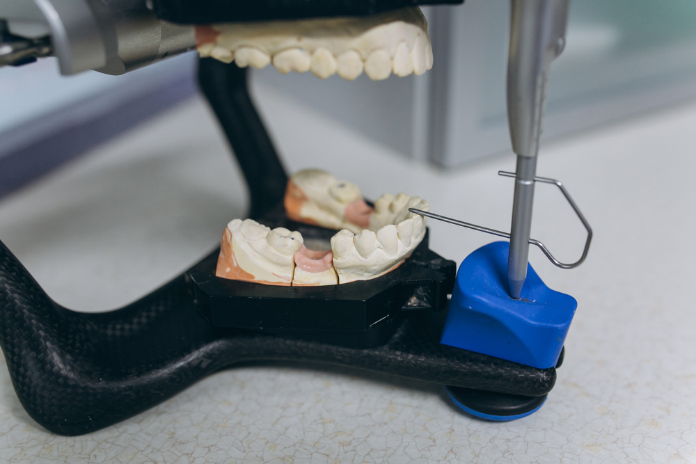 Cuánto Tiempo Dura una Prótesis Dental con Cuidados Adecuados