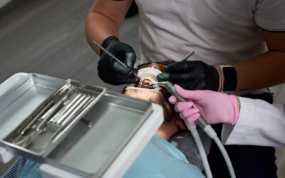 Cada Cuánto Hacer Limpieza Dental: Frecuencia Recomendada por Especialistas