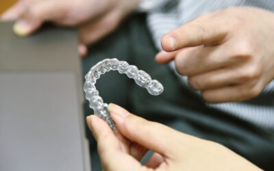 Cuánto Tiempo Deben Usarse los Retenedores Dentales