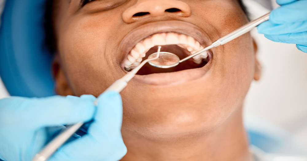 Qué Hace Único al Mantenimiento Periodontal 01